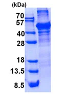 SDS-PAGE - Recombinant Human LCAT protein (denatured) (His tag N-Terminus) (AB139631)