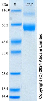 SDS-PAGE - Recombinant Human LCAT Protein Standard (AB316694)