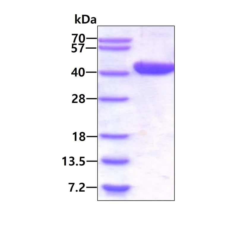 SDS-PAGE - Recombinant Human LCMT1 protein (His tag N-Terminus) (AB123175)