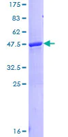 SDS-PAGE - Recombinant Human LCN1 protein (AB116833)