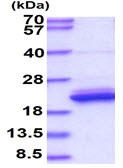SDS-PAGE - Recombinant Human LCN1 protein (AB187451)