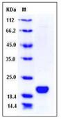 SDS-PAGE - Recombinant Human LCN1 protein (His tag) (AB276407)