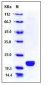 SDS-PAGE - Recombinant Human LCN1 protein (His tag) (AB276407)
