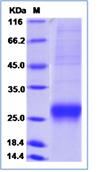 SDS-PAGE - Recombinant Human LCN8 protein (His tag) (AB276671)