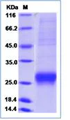 SDS-PAGE - Recombinant Human LCN8 protein (His tag) (AB276671)