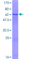SDS-PAGE - Recombinant Human LDH-C protein (AB158814)