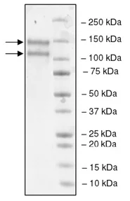 SDS-PAGE - Recombinant human LDL Receptor protein (Biotin) (DDDDK tag C-Terminus + Avi tag C-Terminus) (AB198657)