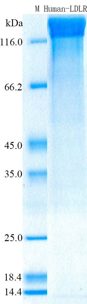 SDS-PAGE - Recombinant Human LDLR Protein Standard (His tag) (AB316419)