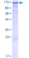 Western blot - Recombinant Human LEO1/RDL protein (AB132311), expandable thumbnail