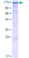 Western blot - Recombinant Human LEO1/RDL protein (GST tag N-Terminus) (AB132311)
