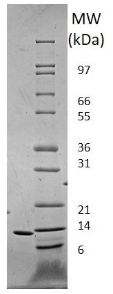 Recombinant human Leptin protein (Active)
