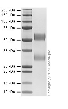 SDS-PAGE - Recombinant Human LGALS9 Protein (AB313365)
