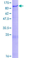 SDS-PAGE - Recombinant Human LH1 protein (AB159142), expandable thumbnail