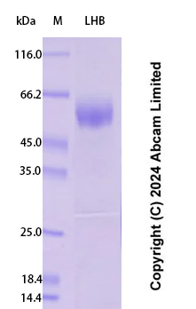SDS-PAGE - Recombinant Human LHB Protein Standard (His tag) (AB323072)