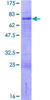SDS-PAGE - Recombinant Human LHX9 protein (AB163448)