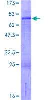 SDS-PAGE - Recombinant Human LHX9 protein (AB163448)