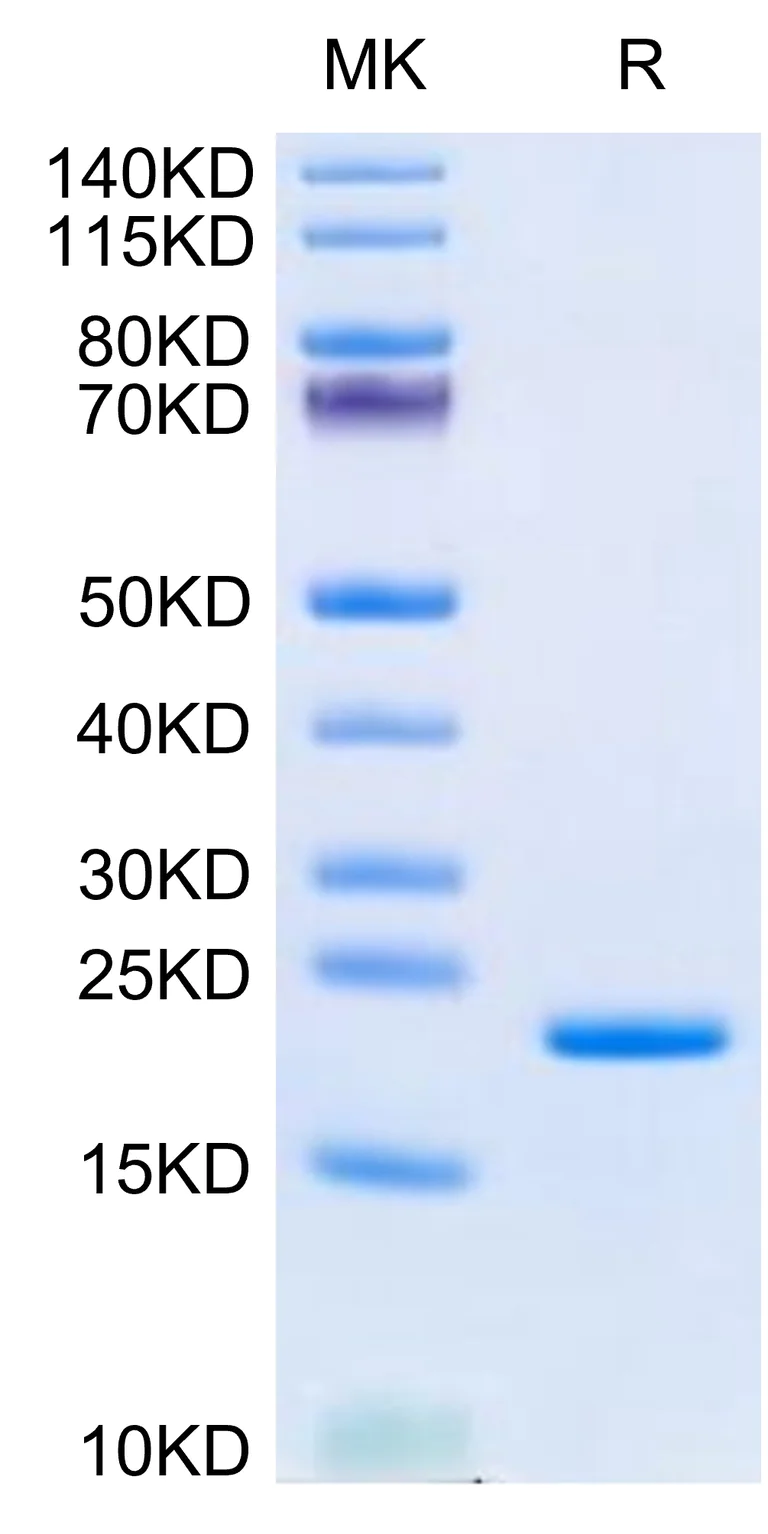 SDS-PAGE - Recombinant Human LIF (Active) protein (AB316046)
