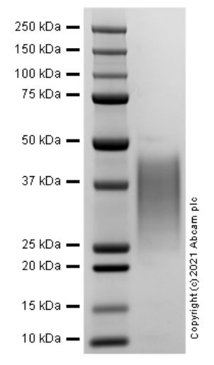 SDS-PAGE - Recombinant Human LIF protein (Active) (AB287941), expandable thumbnail