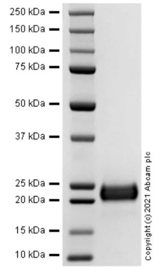 SDS-PAGE - Recombinant Human LIGHT Protein (Active) (AB283905)