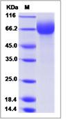 SDS-PAGE - Recombinant Human LILRA1 protein (His tag) (AB276730)