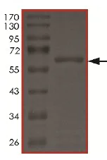 SDS-PAGE - Recombinant human LIM Kinase 1 protein (AB174066)