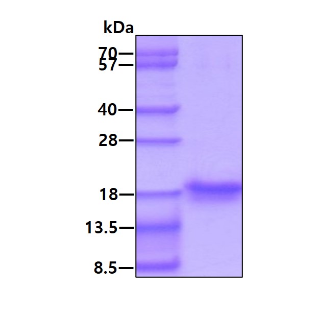 Recombinant Human LIMD2 protein