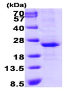 SDS-PAGE - Recombinant Human Lin28A protein (AB89225)