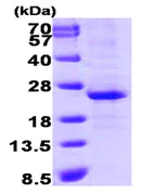 SDS-PAGE - Recombinant Human Lin28A protein (His tag N-Terminus) (AB89225)