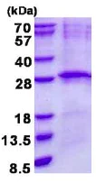 SDS-PAGE - Recombinant Human LIN7B protein (AB137156)