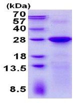 SDS-PAGE - Recombinant Human LIN7C protein (His tag N-Terminus) (AB137173)