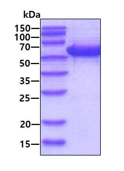 SDS-PAGE - Recombinant Human Lipoamide Dehydrogenase protein (AB93679)