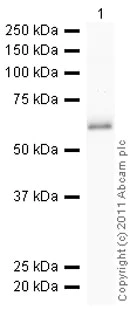 Western blot - Recombinant Human Lipoamide Dehydrogenase protein (His tag N-Terminus) (AB93679)