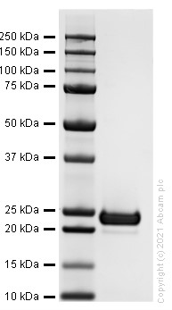 Recombinant human Lipocalin-2 / NGAL protein (Active)