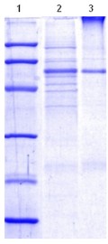 SDS-PAGE - Recombinant Human Lipoprotein lipase (AB115504)