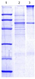 SDS-PAGE - Recombinant Human Lipoprotein lipase (AB115504)