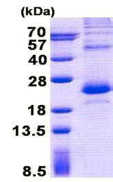 SDS-PAGE - Recombinant Human LITAF protein (denatured) (His tag N-Terminus) (AB150472)
