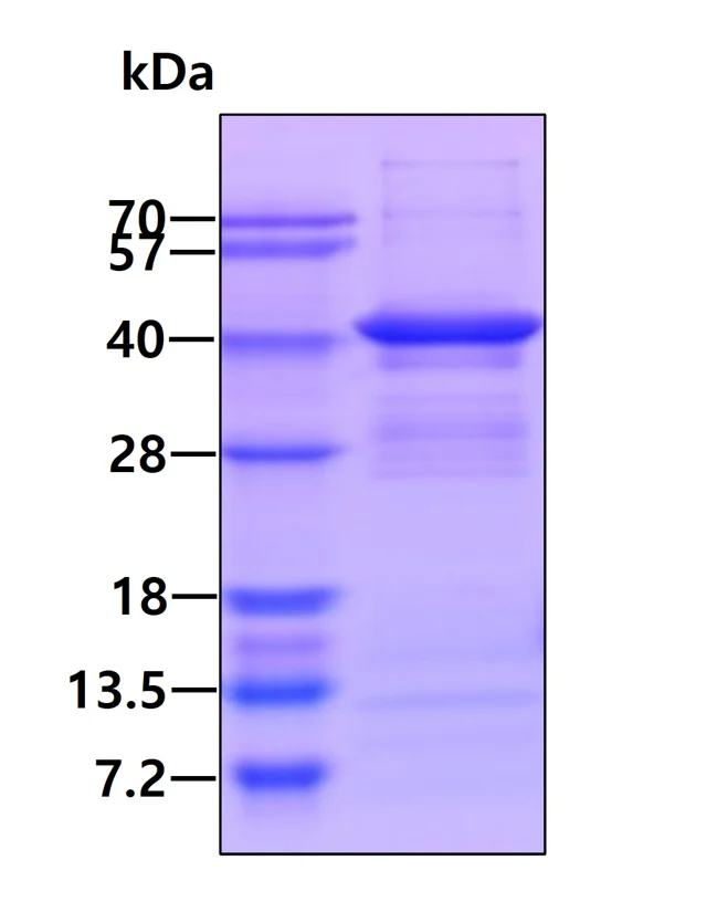 SDS-PAGE - Recombinant Human Liver Arginase protein (His tag C-Terminus) (AB95487)