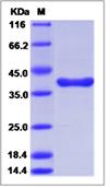 SDS-PAGE - Recombinant Human Liver Arginase protein (Tagged) (AB276404), expandable thumbnail
