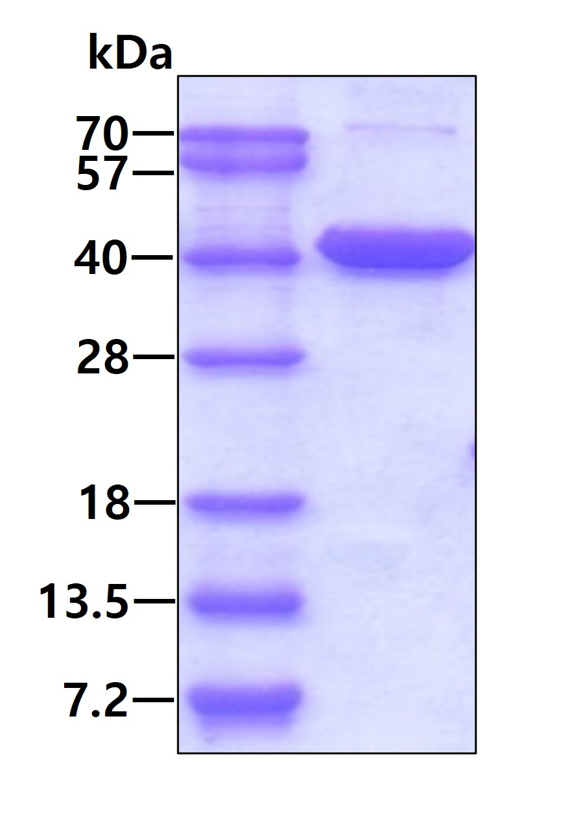 SDS-PAGE - Recombinant Human Livin protein (AB87179), expandable thumbnail