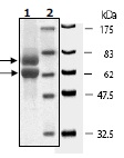 SDS-PAGE - Recombinant Human LKB1 + CAB39 + LYK5 protein (His tag N-Terminus, GST tag N-Terminus) (AB95249)