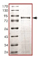 SDS-PAGE - Recombinant Human LKB1 protein (AB119736)