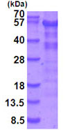 SDS-PAGE - Recombinant Human LKB1 protein (denatured) (His tag N-Terminus) (AB202187)