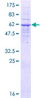 SDS-PAGE - Recombinant Human LMAN2L protein (AB164339)