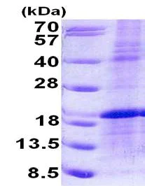 SDS-PAGE - Recombinant Human LMO1 protein (denatured) (His tag N-Terminus) (AB156325)