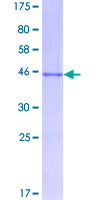 SDS-PAGE - Recombinant Human LMO2 protein (AB152503), expandable thumbnail