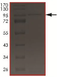 SDS-PAGE - Recombinant Human LMTK2 protein (AB204145)