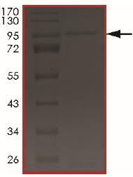 SDS-PAGE - Recombinant Human LMTK2 protein (AB204145)