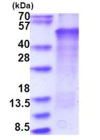 SDS-PAGE - Recombinant Human LMX1b protein (denatured) (His tag N-Terminus) (AB181911)