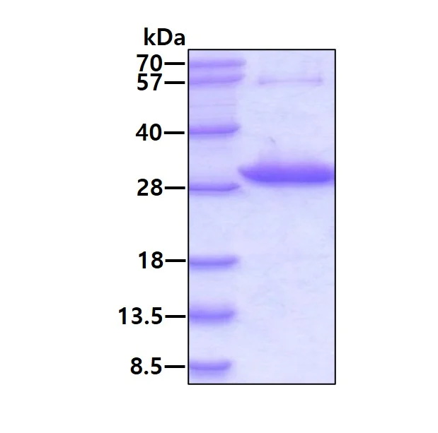 SDS-PAGE - Recombinant Human LOC134147/CMBL protein (AB130050)