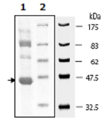 SDS-PAGE - Recombinant Human LOK protein (Tagged) (AB271602)